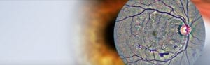 Tele-optometry Retinal photo banner
