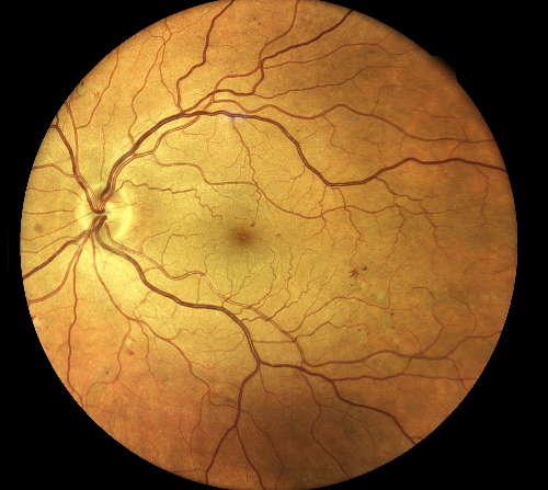 compass retinal image